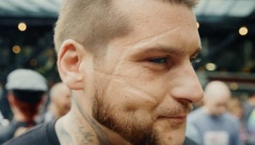 Popek opowie o swoich bliznach