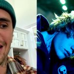 Justin Bieber pokazał sparaliżowaną twarz. Wokalista ma problemy zdrowotne