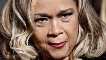 Etta James ma problemy ze zdrowiem